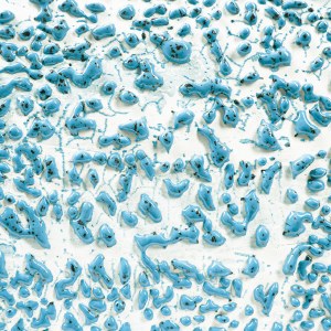 CR22 SPECKLED TEAL CRAWL